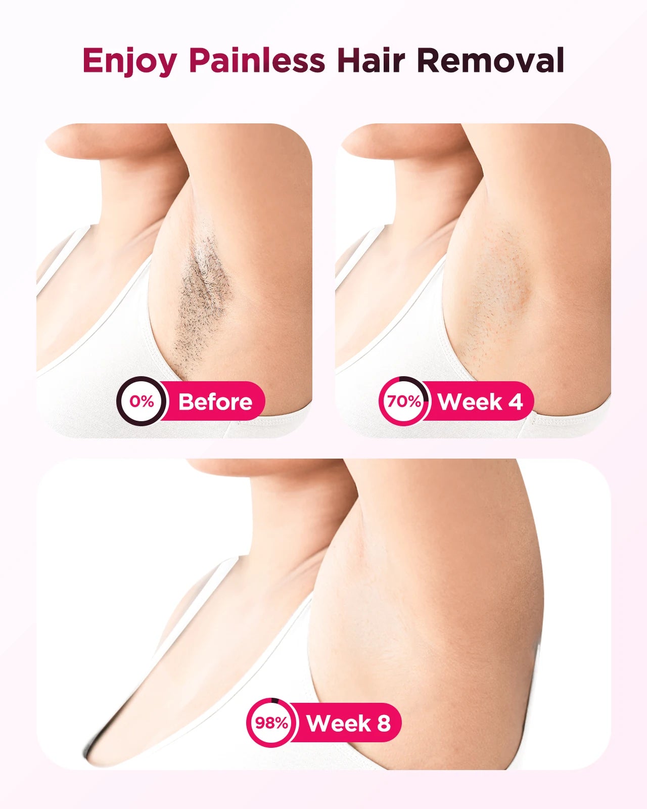 Totmizby IPL Hair Removal Epilator Laser Device For All Areas